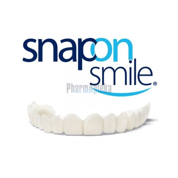 Snap-On Smile ❖ veneers ❖ in Teplice